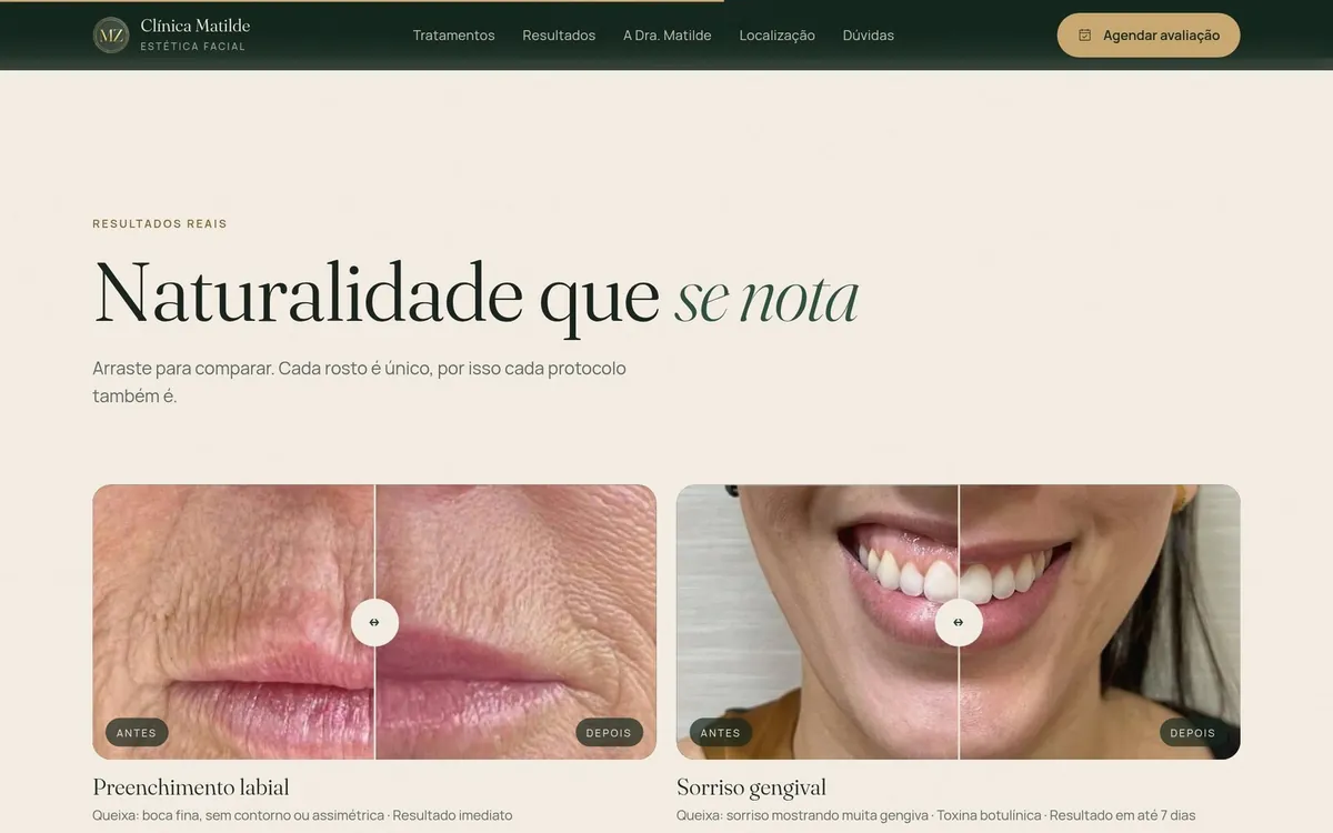Seção Resultados reais com comparação de antes e depois arrastável